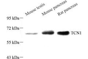 Western blot analysis of TCN1 (ABIN7075950),at dilution of 1: 800 (TCN1 antibody)