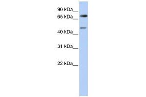 DTL antibody used at 1 ug/ml to detect target protein. (CDT2/RAMP antibody)