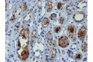 Immunohistochemical staining of paraffin-embedded Human Kidney tissue using anti-MPI mouse monoclonal antibody. (MPI antibody)