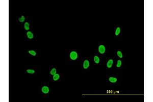 Immunofluorescence of  purified  MaxPab antibody to PTBP1 on HeLa cell. (PTBP1 antibody  (AA 1-557))