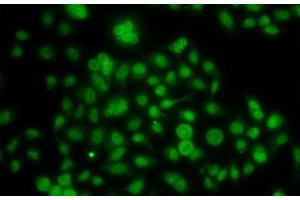 Immunofluorescence analysis of A-549 cells using ATOH7 Polyclonal Antibody (ATOH7 antibody)