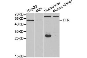 Western Blotting (WB) image for anti-Transthyretin (TTR) antibody (ABIN3017544) (TTR antibody)