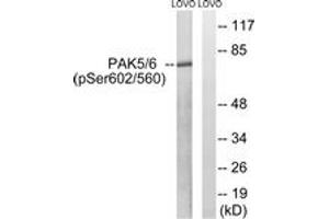 Western blot analysis of extracts from LOVO cells treated with PMA 125ng/ml 30', using PAK5/6 (Phospho-Ser602/Ser560) Antibody. (PAK5/6 (AA 566-615), (pSer602) antibody)
