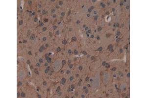 Immunohistochemistry (IHC) image for anti-2',3'-Cyclic Nucleotide 3' phosphodiesterase (CNP) (AA 110-365) antibody (ABIN5013036)