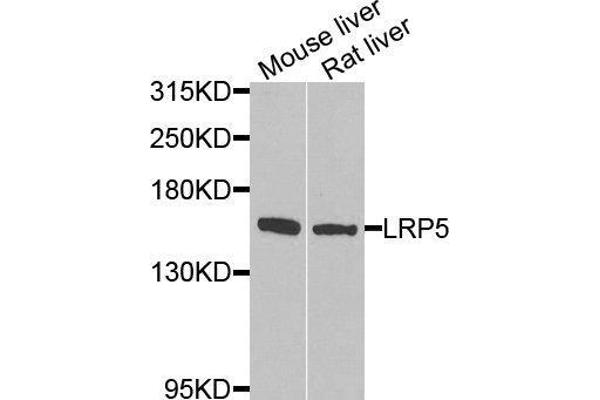 LRP5 anticorps  (AA 1000-1250)
