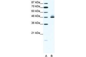 Western Blotting (WB) image for anti-Cholinergic Receptor, Nicotinic, beta 2 (Neuronal) (CHRNB2) antibody (ABIN2463733) (CHRNB2 antibody)