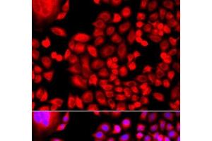 Immunofluorescence analysis of A549 cells using MTHFD1L Polyclonal Antibody (MTHFD1L antibody)