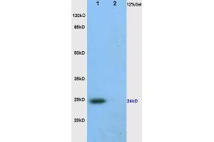 L1 human colon carcinoma, L2 rat heart lysates probed (ABIN872390) at 1:200 in 4 °C. (VEGFA antibody  (AA 81-132))