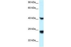 Image no. 1 for anti-Ras-Like Without CAAX 1 (RIT1) (C-Term) antibody (ABIN6747636) (RIT1 antibody  (C-Term))