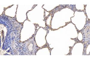 Immunohistochemistry (IHC) image for anti-Intercellular Adhesion Molecule 1 (ICAM1) (AA 27-209) antibody (ABIN7431974)