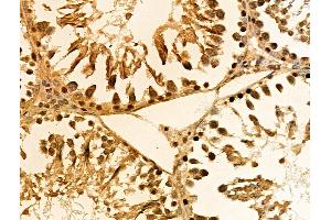 ABIN6257940 and ABIN6274488 at 1/100 staining Rat testis tissue by IHC-P. (ATF6B antibody  (Internal Region))
