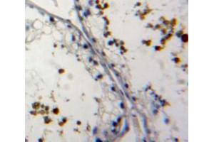 IHC-P analysis of testis tissue, with DAB staining. (NUP62 antibody  (AA 186-432))