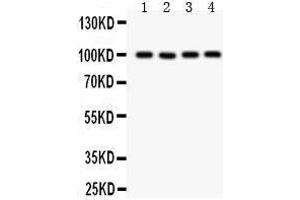 Anti- TRP 7 Picoband antibody, Western blotting All lanes: Anti TRP 7  at 0. (TRPC7 antibody  (AA 716-862))