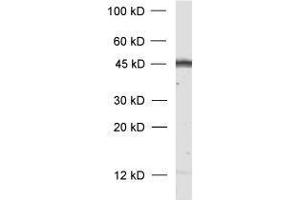 dilution: 1 : 1000, sample: rat brain homogenate (GAP43 antibody)