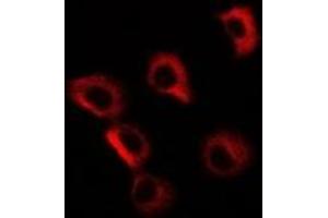 Immunofluorescent analysis of GP73 staining in MCF7 cells.
