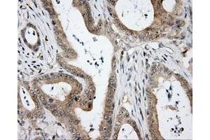 Immunohistochemical staining of paraffin-embedded Kidney tissue using anti-HDAC10 mouse monoclonal antibody.