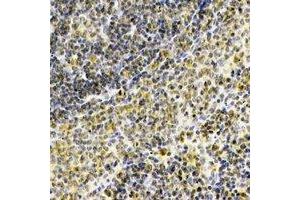 Immunohistochemical analysis of Septin 1 staining in human spleen formalin fixed paraffin embedded tissue section. (Septin 1 antibody)