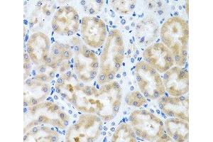 Immunohistochemistry of paraffin-embedded Rat kidney using INHBC Polyclonal Antibody at dilution of 1:100 (40x lens). (INHBC antibody)