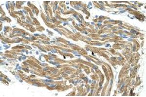 Immunohistochemical staining (Formalin-fixed paraffin-embedded sections) of human muscle with HAL polyclonal antibody  at 4-8 ug/mL working concentration. (HAL antibody  (C-Term))