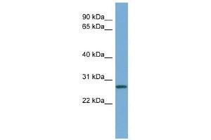 Western Blot showing CCNDBP1 antibody used at a concentration of 1-2 ug/ml to detect its target protein. (CCNDBP1 antibody  (Middle Region))