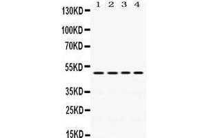 Western Blotting (WB) image for anti-Damage-Specific DNA Binding Protein 2, 48kDa (DDB2) (AA 1-115) antibody (ABIN3043488) (DDB2 antibody  (AA 1-115))
