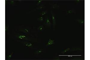 Immunofluorescence (IF) image for anti-GRIP and Coiled-Coil Domain Containing 1 (GCC1) (AA 1-775) antibody (ABIN949640)