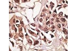 Immunohistochemistry (IHC) image for anti-Bone Morphogenetic Protein Receptor 1A (BMPR1A) (AA 21-51) antibody (ABIN3030184)