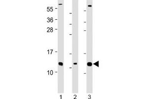 Western blot testing of human 1) Caco-2, 2) RMPI-8226 and 3) SH-SY5Y cell lysate with CKS2 antibody at 1:2000. (CKS2 antibody  (Regulatory Subunit 2))