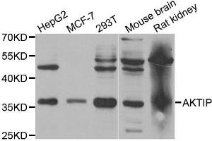 Western Blotting (WB) image for anti-AKT Interacting Protein (AKTIP) antibody (ABIN1882366)