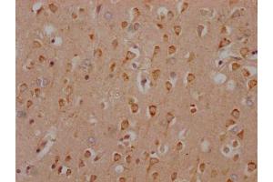 IHC image of ABIN7127314 diluted at 1:100 and staining in paraffin-embedded human brain tissue performed on a Leica BondTM system.