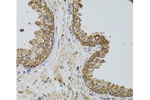 Immunohistochemistry of paraffin-embedded Human prostate using SELP Polyclonal Antibody at dilution of 1:100 (40x lens). (P-Selectin antibody)