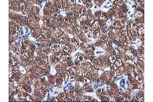 Immunohistochemical staining of paraffin-embedded Human liver tissue using anti-CYP2A6 mouse monoclonal antibody. (CYP2A6 antibody)