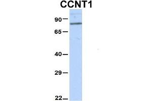 Host:  Rabbit  Target Name:  CCNT1  Sample Type:  Hela  Antibody Dilution:  1. (Cyclin T1 antibody  (N-Term))