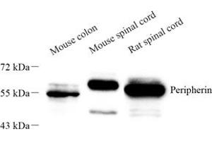 Peripherin antibody