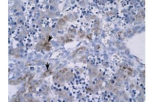RGS9 antibody was used for immunohistochemistry at a concentration of 4-8 ug/ml to stain Hepatocytes (arrows) in Human Liver. (RGS antibody  (N-Term))