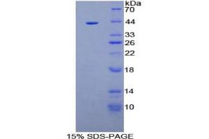 SDS-PAGE analysis of Human AQP2 Protein. (AQP2 Protein)