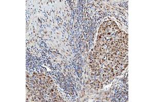 IHC analysis of U1-C/SNRPC using anti-U1-C/SNRPC antibody (ABIN7599016). (SNRPC antibody  (AA 1-159))