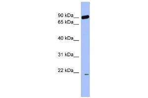 WB Suggested Anti-RNF135 Antibody Titration:  0.