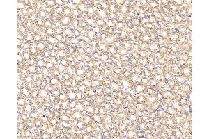 Immunohistochemistry analysis of paraffin-embedded Rat stomach cancer using CK-7 Monoclonal Antibody at dilution of 1:300. (Cytokeratin 7 antibody)