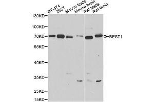 Western blot analysis of extracts of various cell lines, using BEST1 antibody (ABIN4903043) at 1:1000 dilution. (Bestrophin 1 antibody)