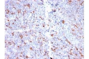 Formalin-fixed, paraffin-embedded human Tonsil stained with S100A8/A9 Complex Recombinant Rabbit Monoclonal Antibody (MAC3157R). (Recombinant S100A8 antibody)