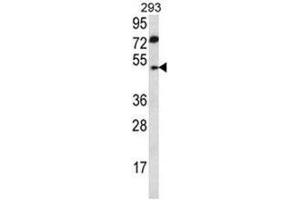 ABHD2 Antibody (Center) western blot analysis in 293 cell line lysates (35 µg/lane).