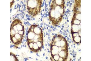 Immunohistochemistry of paraffin-embedded Human colon using GIPC2 Polyclonal Antibody at dilution of 1:100 (40x lens). (GIPC2 antibody)