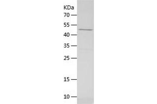 NR2F6 Protein (AA 1-404) (His tag)