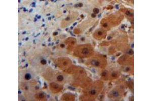 Used in DAB staining on fromalin fixed paraffin-embedded Liver tissue (ORM1 antibody  (AA 19-207))