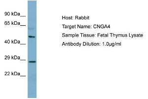 Host: Rabbit Target Name: CNGA4 Sample Type: Fetal Thymus lysates Antibody Dilution: 1. (CNGA4 antibody  (N-Term))