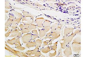 Formalin-fixed and paraffin embedded smooth muscle of rat colon labeled with Anti CTHRC1 Polyclonal Antibody, Unconjugated (ABIN759281) at 1:200 followed by conjugation to the secondary antibody and DAB staining (CTHRC1 antibody  (AA 31-130))