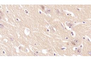 Detection of CD97 in Human Cerebrum Tissue using Monoclonal Antibody to Cluster Of Differentiation 97 (CD97) (CD97 antibody  (AA 58-260))