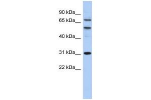 WB Suggested Anti-SSRP1 Antibody Titration: 0. (SSRP1 antibody  (Middle Region))