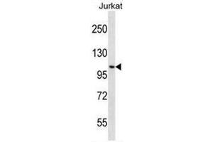 CENPC1 Antibody (Center) western blot analysis in Jurkat cell line lysates (35µg/lane). (CENPC1 antibody  (Middle Region))